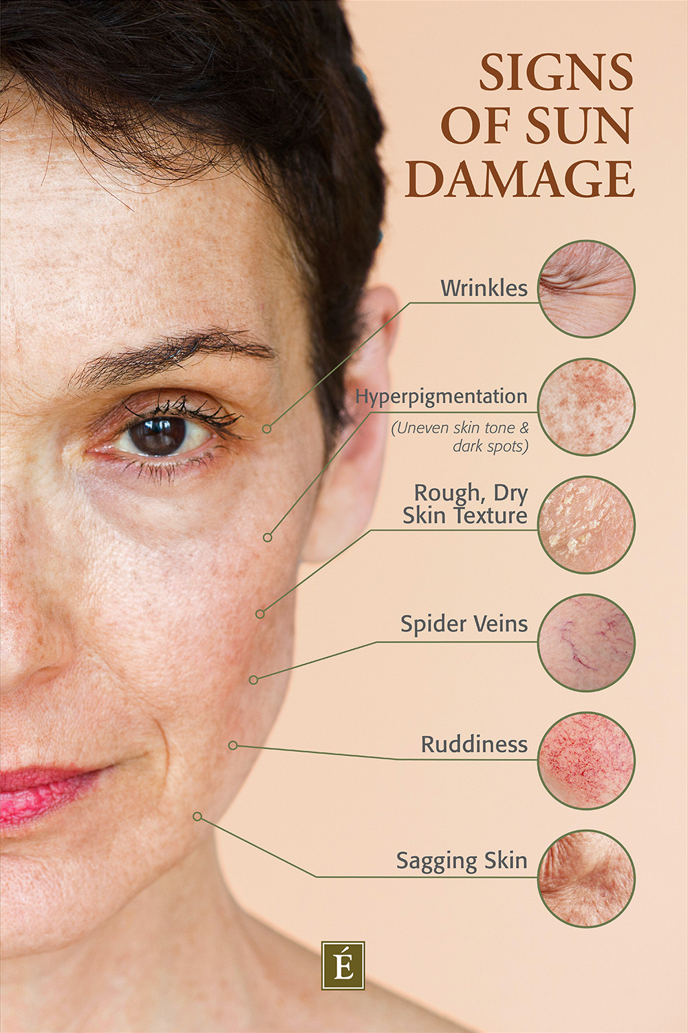 signs of sun damage